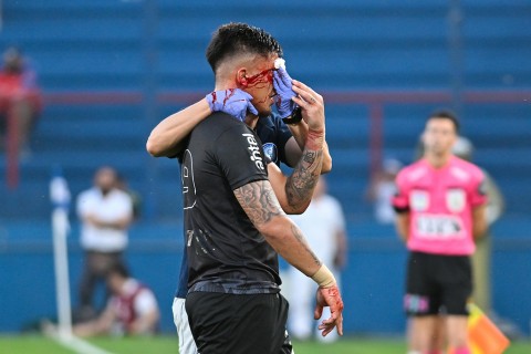 Mauro Brasil y su golpazo ante Nacional: “quería seguir pero estuvieron bien en sacarme”