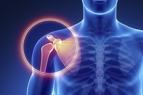 ¿Llega Nahuel Herrera? Lo que dicen los especialistas